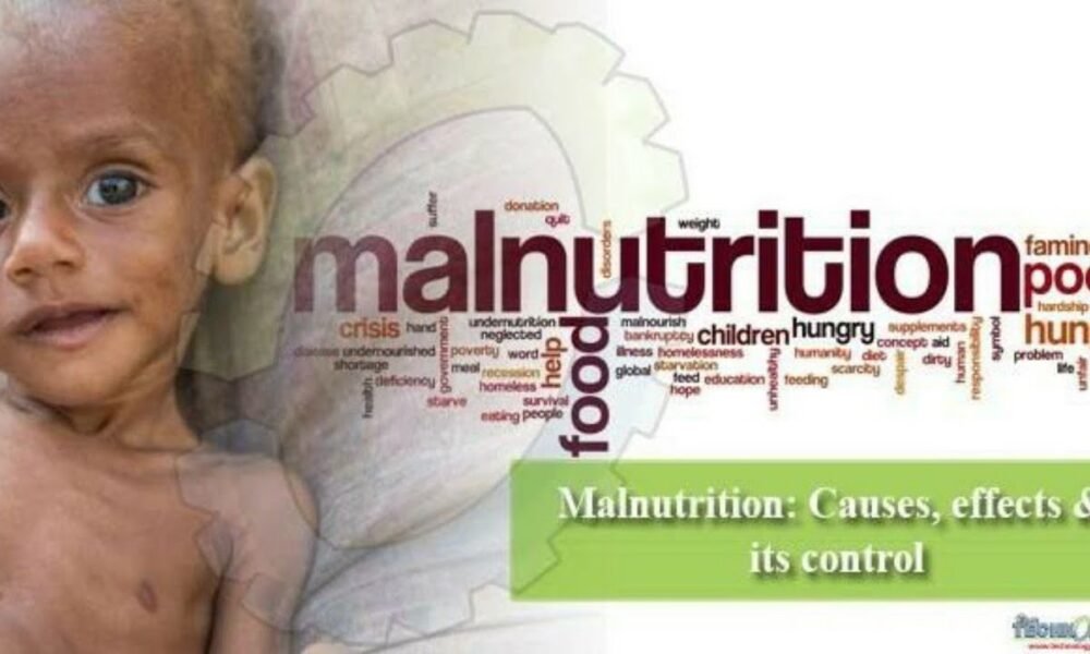 WHO: South Sudan’s Silent Killer—Acute Malnutrition
