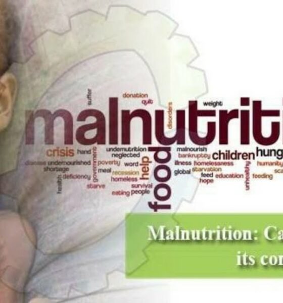 WHO: South Sudan’s Silent Killer—Acute Malnutrition